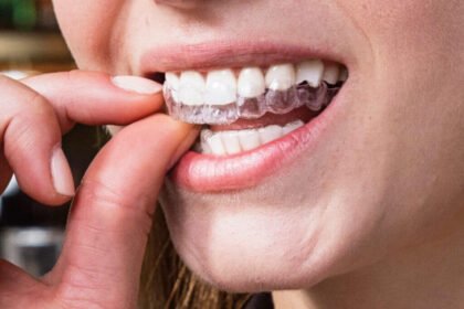 Can I Wear Braces as an Adult? Can I Wear Braces as an Adult?