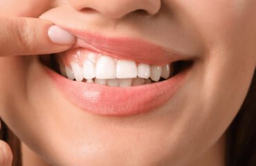 “HEALTHY GUMS, HEALTHY MOUTH”