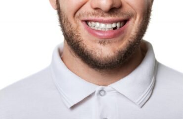 Do I Have To Replace My Extracted Tooth