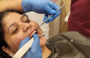 root canal cost in India