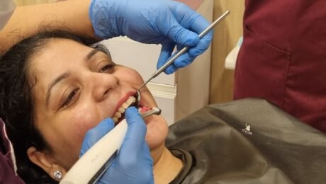 Redefining Root Canals in Delhi