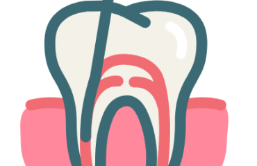 Root Canal Treatment in GK2