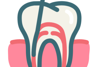 root canal Root Canal Treatment in GK2