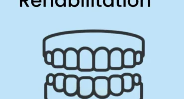 full-mouth-rehabilitation-in-pune-500×500
