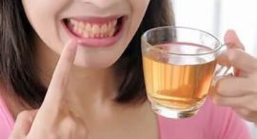 food foods that make your teeth age faster