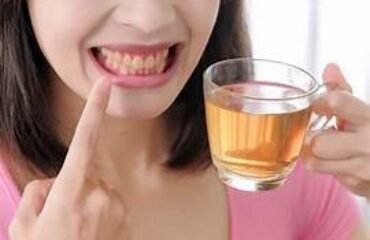 foods that make your teeth age faster